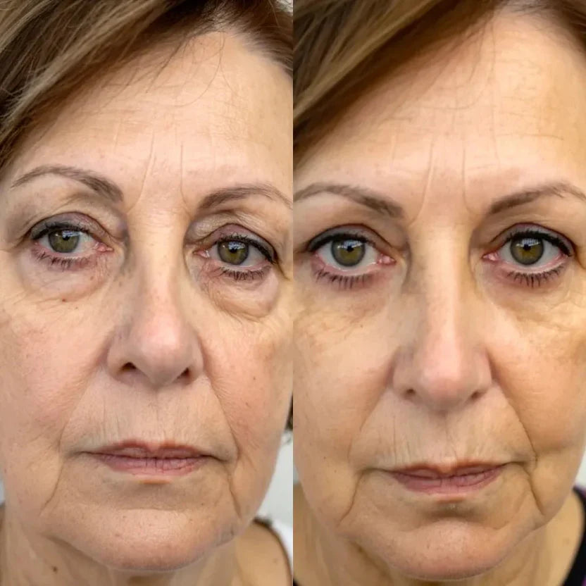 LumiEyes™ Advanced Red Light Eye Therapy